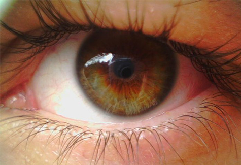 Разрыв сетчатки глаза сколько стоит операция