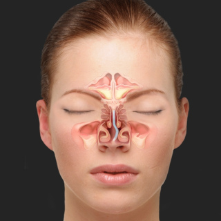 Искривление перегородки носа — ЛОР клиника №1