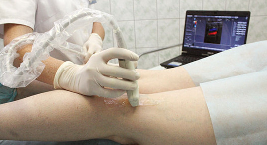 Подготовка к эндовенозной лазерной коагуляции варикозных вен