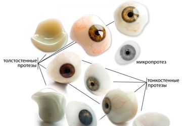 Операции при протезировании глазного яблока